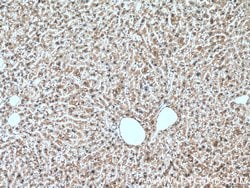 SERPINA7 Mouse anti-Human, Mouse, Clone: 1B11B10, Proteintech 150 &mu;L;