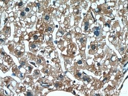 SERPINA7 Mouse anti-Human, Mouse, Clone: 1B11B10, Proteintech 150 &mu;L;
