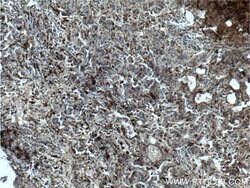 PSAP Mouse anti-Human, Clone: 2F11B2, Proteintech 150 &mu;L; Unconjugated:Antibodies,