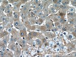 Thumbnail_Hemopexin Mouse anti-Human, Porcine, Rat, Clone: 3A9D6, Proteintech 150