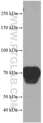 Thumbnail_Hemopexin Mouse anti-Human, Porcine, Rat, Clone: 3A9D6, Proteintech 150