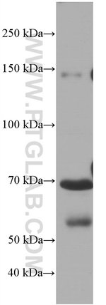 Thumbnail_Hemopexin Mouse anti-Human, Porcine, Rat, Clone: 3A9D6, Proteintech 150