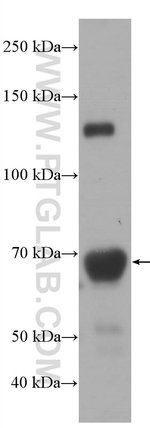 Thumbnail_Hemopexin Mouse anti-Human, Porcine, Rat, Clone: 3A9D6, Proteintech 150