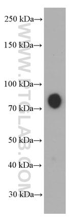 Thumbnail_Hemopexin Mouse anti-Human, Porcine, Rat, Clone: 3A9D6, Proteintech 150