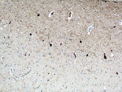 Calretinin Mouse anti-Human, Mouse, Porcine, Rat, Clone: 2D7A9, Proteintech:Antikörper:Primärantikörper