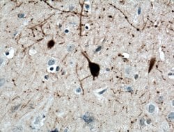 Calretinin Mouse anti-Human, Mouse, Porcine, Rat, Clone: 2D7A9, Proteintech:Antikörper:Primärantikörper