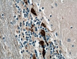 Calretinin Mouse anti-Human, Mouse, Porcine, Rat, Clone: 2D7A9, Proteintech:Antikörper:Primärantikörper