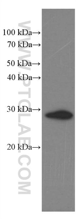 Calretinin Mouse anti-Human, Mouse, Porcine, Rat, Clone: 2D7A9, Proteintech:Antikörper:Primärantikörper