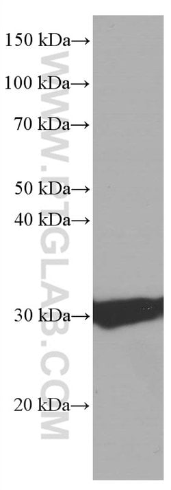 Calretinin Mouse anti-Human, Mouse, Porcine, Rat, Clone: 2D7A9, Proteintech:Antikörper:Primärantikörper