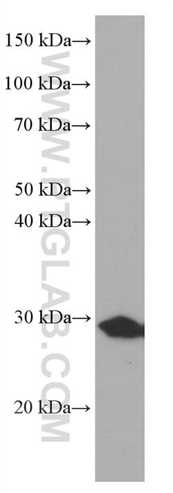 Calretinin Mouse anti-Human, Mouse, Porcine, Rat, Clone: 2D7A9, Proteintech:Antikörper:Primärantikörper