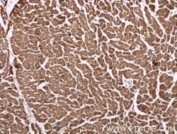 CNOT1 Mouse anti-Human, Clone: 1A10A11, Proteintech 150 &mu;L; Unconjugated:Antibodies,