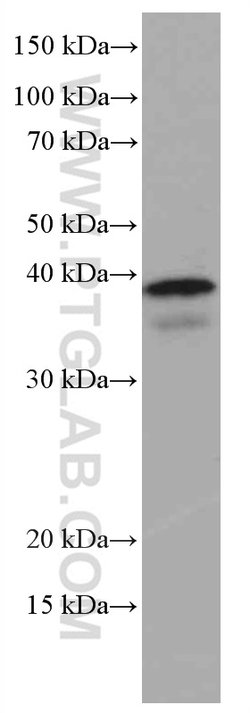 ING2 Mouse anti-Human, Mouse, Rat, Clone: 2C3A7, Proteintech 20 &mu;L;