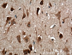 OLIG2 Mouse anti-Human, Mouse, Rat, Clone: 1E8C5, Proteintech:Antibodies:Primary