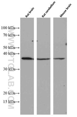 OLIG2 Mouse anti-Human, Mouse, Rat, Clone: 1E8C5, Proteintech:Antibodies:Primary