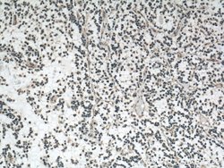 OLIG2 Mouse anti-Human, Mouse, Rat, Clone: 1E8C5, Proteintech:Antibodies:Primary