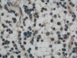 OLIG2 Mouse anti-Human, Mouse, Rat, Clone: 1E8C5, Proteintech:Antibodies:Primary