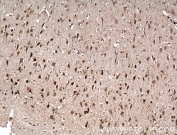 OLIG2 Mouse anti-Human, Mouse, Rat, Clone: 1E8C5, Proteintech:Antibodies:Primary