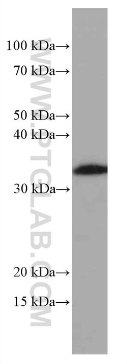 OLIG2 Mouse anti-Human, Mouse, Rat, Clone: 1E8C5, Proteintech:Antibodies:Primary