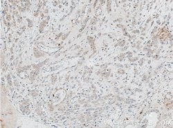 ACOT9 Mouse anti-Human, Rat, Clone: 3F10G5, Proteintech 150 &mu;L; Unconjugated:Antibodies,