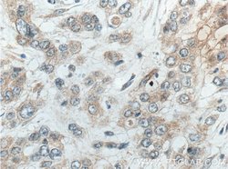 ACOT9 Mouse anti-Human, Rat, Clone: 3F10G5, Proteintech 150 &mu;L; Unconjugated:Antibodies,