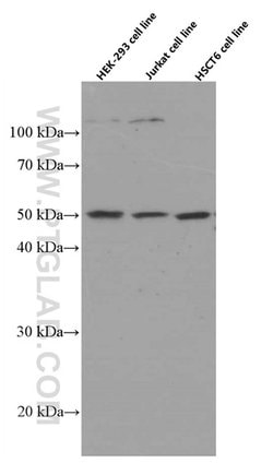 ACOT9 Mouse anti-Human, Rat, Clone: 3F10G5, Proteintech 150 &mu;L; Unconjugated:Antibodies,