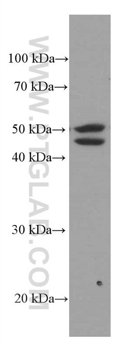 ACOT9 Mouse anti-Human, Rat, Clone: 3F10G5, Proteintech 150 &mu;L; Unconjugated:Antibodies,