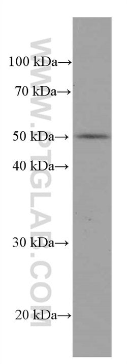 ACOT9 Mouse anti-Human, Rat, Clone: 3F10G5, Proteintech 150 &mu;L; Unconjugated:Antibodies,