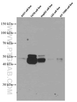 Cathepsin D Mouse anti-Human, Clone: 2F6F7, Proteintech:Antibodies:Primary