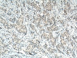 AMPK alpha Mouse anti-Human, Mouse, Rat, Clone: 1H8E1, Proteintech:Antibodies:Primary