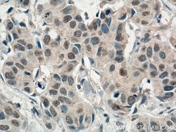 AMPK alpha Mouse anti-Human, Mouse, Rat, Clone: 1H8E1, Proteintech:Antibodies:Primary