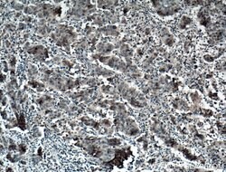 AMPK alpha Mouse anti-Human, Mouse, Rat, Clone: 1H8E1, Proteintech:Antibodies:Primary