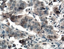 AMPK alpha Mouse anti-Human, Mouse, Rat, Clone: 1H8E1, Proteintech:Antibodies:Primary