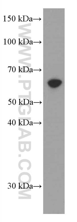AMPK alpha Mouse anti-Human, Mouse, Rat, Clone: 1H8E1, Proteintech:Antibodies:Primary