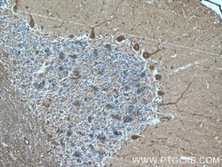Huntingtin Mouse anti-Human, Mouse, Clone: 2F6C9, Proteintech 150 &mu;L | Buy Online | Proteintech Group Inc | Fisher Scientific