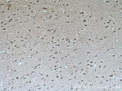Huntingtin Mouse anti-Human, Mouse, Clone: 2F6C9, Proteintech 150 &mu;L | Buy Online | Proteintech Group Inc | Fisher Scientific