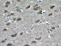 Huntingtin Mouse anti-Human, Mouse, Clone: 2F6C9, Proteintech 150 &mu;L | Buy Online | Proteintech Group Inc | Fisher Scientific