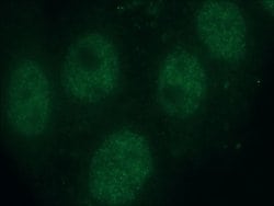 SMARCA4 Mouse anti-Human, Rat, Clone: 2E6B6, Proteintech:Antibodies:Primary