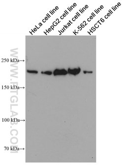 SMARCA4 Mouse anti-Human, Rat, Clone: 2E6B6, Proteintech:Antibodies:Primary