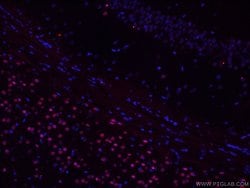 TBR1 Mouse anti-Human, Mouse, Porcine, Rat, Clone: 5C3A5, Proteintech 150 &mu;L | Buy Online | Proteintech Group Inc | Fisher Scientific