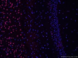 TBR1 Mouse anti-Human, Mouse, Porcine, Rat, Clone: 5C3A5, Proteintech 150 &mu;L | Buy Online | Proteintech Group Inc | Fisher Scientific