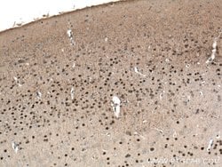 TBR1 Mouse anti-Human, Mouse, Porcine, Rat, Clone: 5C3A5, Proteintech 150 &mu;L | Buy Online | Proteintech Group Inc | Fisher Scientific