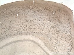 TBR1 Mouse anti-Human, Mouse, Porcine, Rat, Clone: 5C3A5, Proteintech 150 &mu;L | Buy Online | Proteintech Group Inc | Fisher Scientific