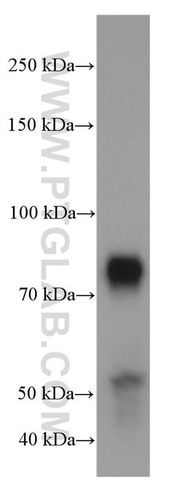 TBR1 Mouse anti-Human, Mouse, Porcine, Rat, Clone: 5C3A5, Proteintech 150 &mu;L | Buy Online | Proteintech Group Inc | Fisher Scientific