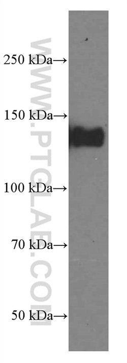 LATS1 Mouse anti-Human, Clone: 2A8F1, Proteintech:Antibodies:Primary Antibodies
