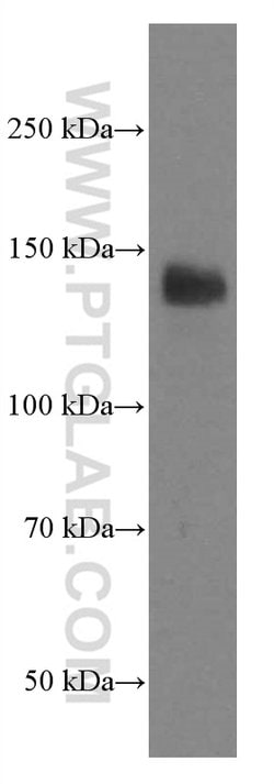 LATS1 Mouse anti-Human, Clone: 2A8F1, Proteintech:Antibodies:Primary Antibodies