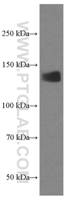 LATS1 Mouse anti-Human, Clone: 2A8F1, Proteintech:Antibodies:Primary Antibodies