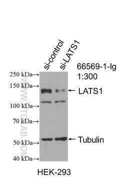 LATS1 Mouse anti-Human, Clone: 2A8F1, Proteintech:Antibodies:Primary Antibodies