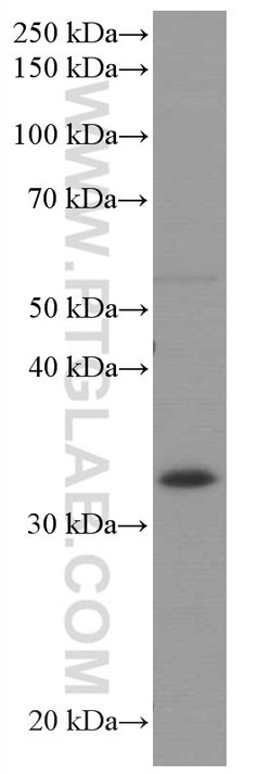 AMPK beta 2 Mouse anti-Human, Mouse, Rat, Clone: 2D5C1, Proteintech 150