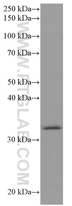 AMPK beta 2 Mouse anti-Human, Mouse, Rat, Clone: 2D5C1, Proteintech 150
