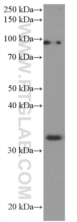 AMPK beta 2 Mouse anti-Human, Mouse, Rat, Clone: 2D5C1, Proteintech 150